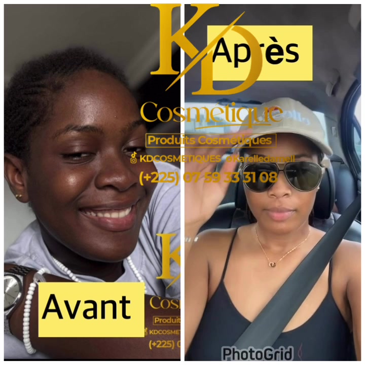 Avant / Après